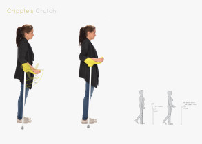 Agnieszka Dudzińska, Projekt kuli ortopedycznej, 2012–2013